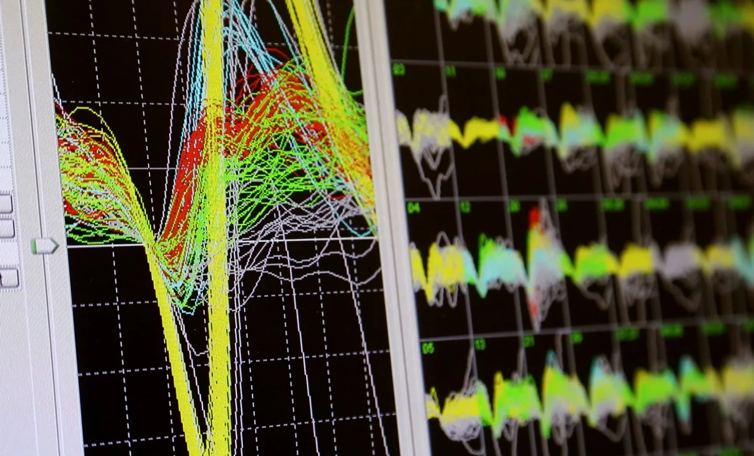Computer displays showing brain-signal traces and neural data visualizations